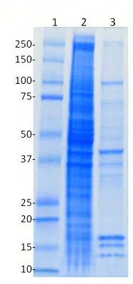 10x RIPA Buffer